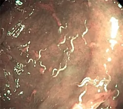 Klo würmer im roter Wurm
